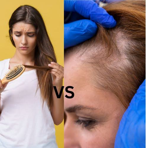 hair loss vs hair thinning