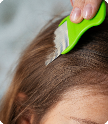 best way to detangle lice from hair